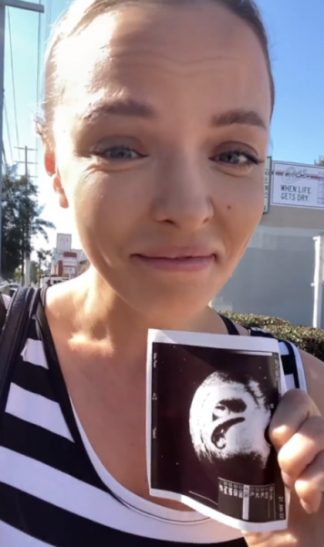 Звезда &laquo;Барвихи&raquo; Орлова беременна двойней