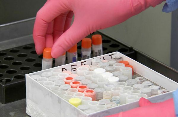 Регулирование клеточных продуктов предложили соотнести с нормами ЕАЭС Регулирование клеточных продуктов предложили соотнести с нормами ЕАЭС